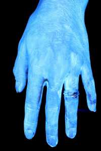 Tangan terlihat kotor ketika dilihat melalui kamera UV khusus ini .