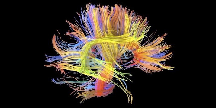 Gaya Hidup Ternyata Pengaruhi Fungsi Otak