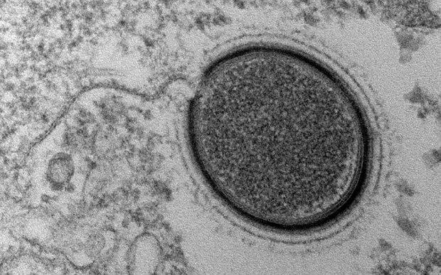 Virus Berusia 30,000 Tahun Ditemukan di Siberia