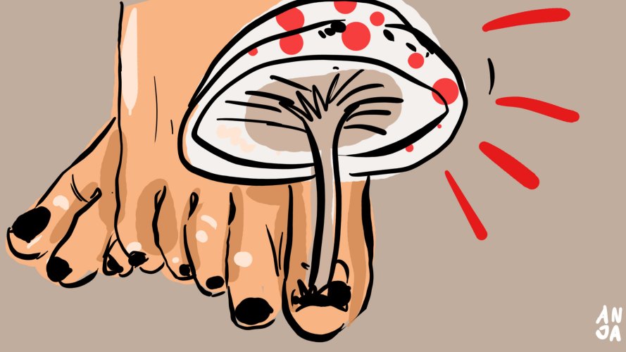ilustrasi jamur kuku kaki. (Anja Arowana)