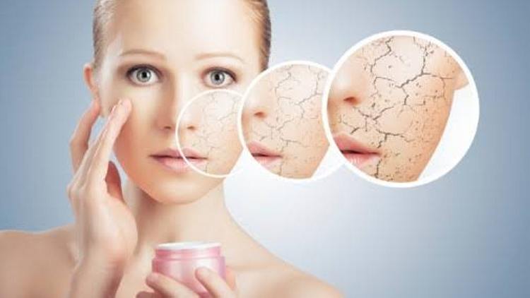 Mengenal Kandungan Polyglutamic Acid di Skincare untuk Melembapkan Kulit