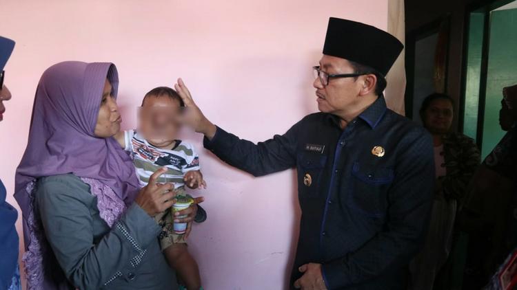 Wali Kota Malang Sutiaji sambangi bayi Arsa penderita meningokel. (Humas Pemkot Malang)