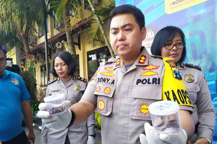 Tulang bayi dibawa Kapolres Malang Kota AKBP Dony Alexander. (deny rahmawan)