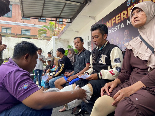 Polresta Malang Kota Beri Korban Kecelakaan Kaki Palsu